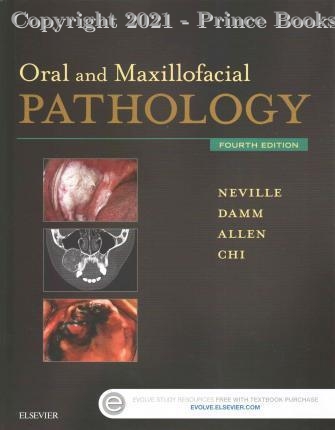 oral and Maxillofacial Pathology, 4e