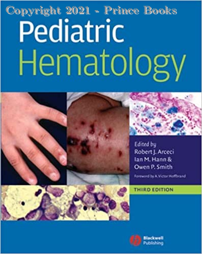 pediatric hematology, 3e