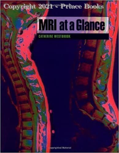 MRI at a Glance by Catherine Westbrook, 1e