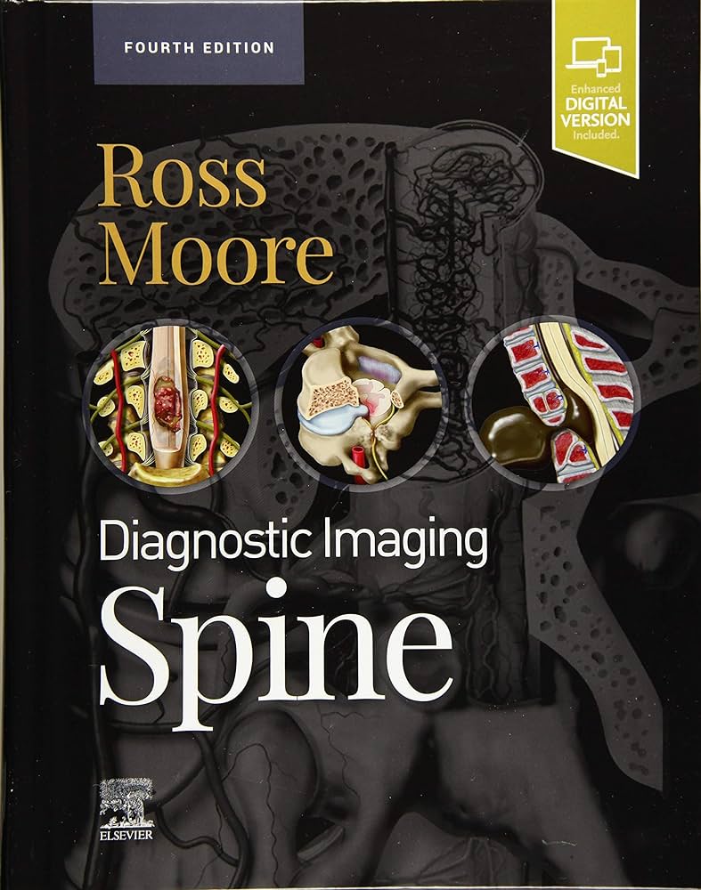 Diagnostic Imaging: Spine, 4e
