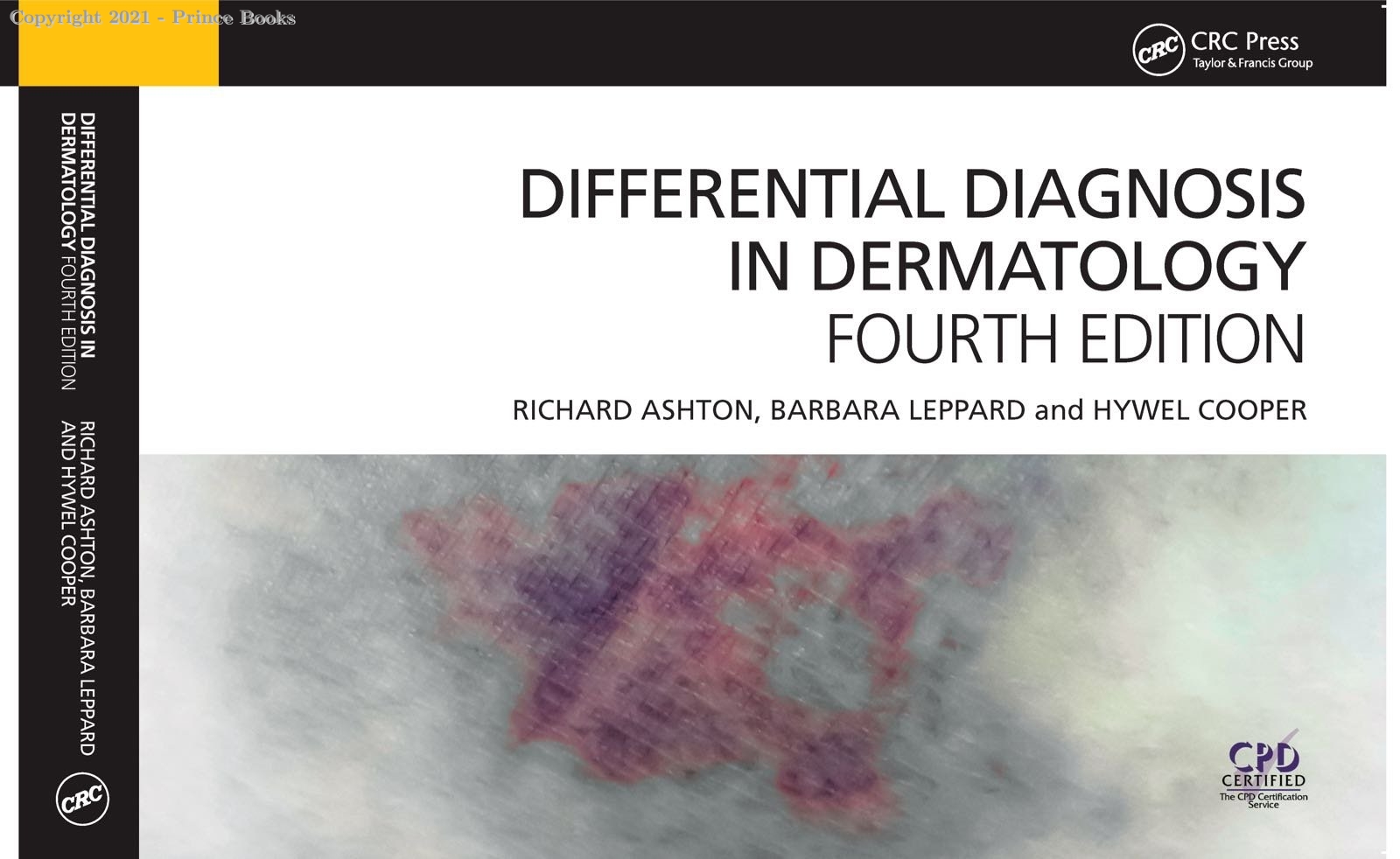 DIFFERENTIAL DIAGNOSIS IN DERMATOLOGY, 4E