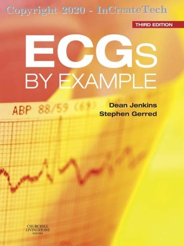 ECGs by Example, 3e