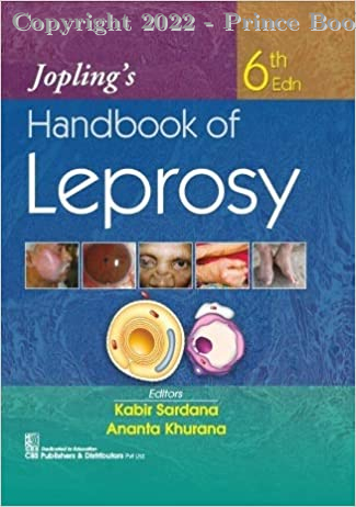 Jopling's Handbook of Leprosy