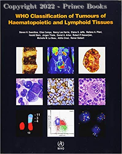 WHO Classification of Tumours of Haematopoietic and Lymphoid Tissues