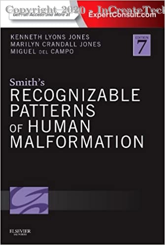 Smith's Recognizable Patterns of Human Malformation, 7e