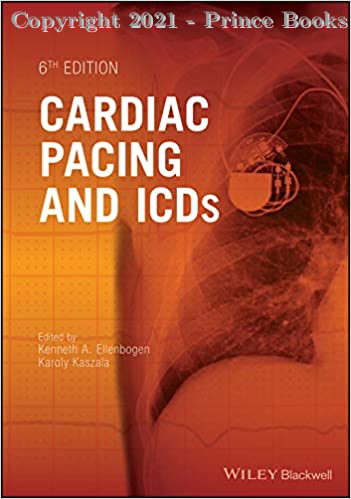 Cardiac Pacing and ICDs, 6e
