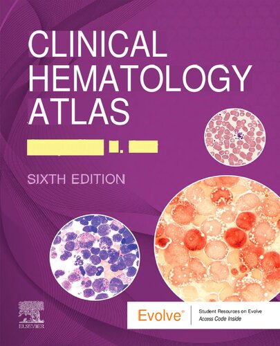 Clinical Hematology Atlas 6e