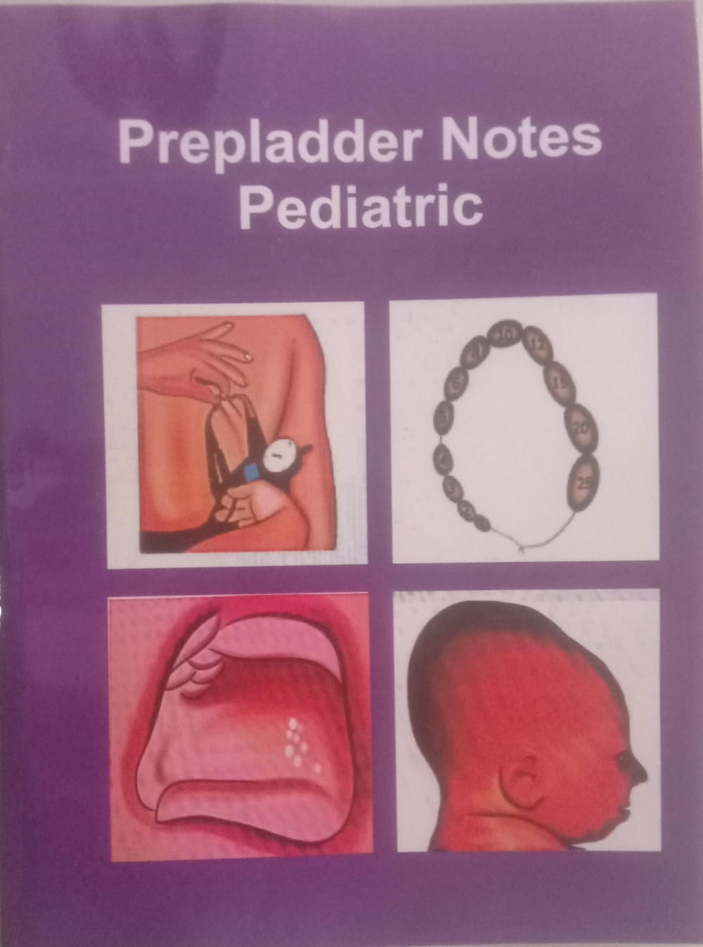 prepladder notes pediatric