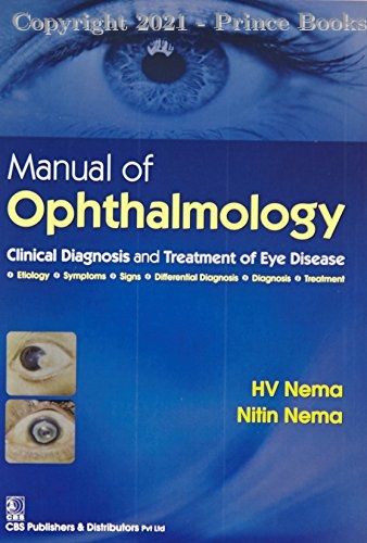 Manual of Ophthalmology Clinical Diagnosis and Treatment of Eye Disease