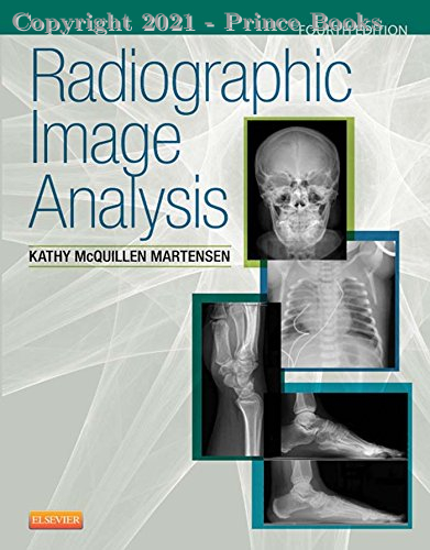 Radiographic Image Analysis, 1e