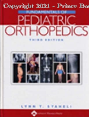 Fundamentals of Pediatric Orthopedics, 3e