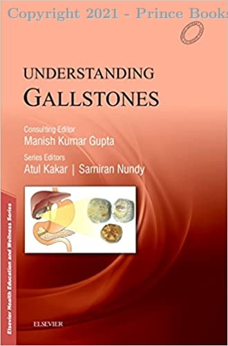 Understanding Gallistones