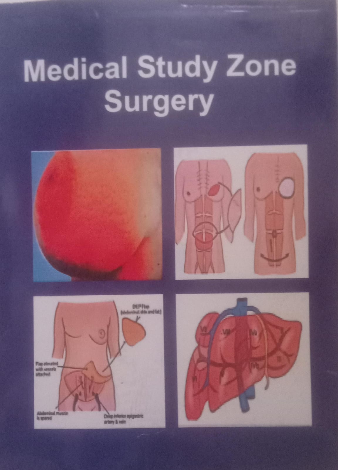 medical study zone surgery 