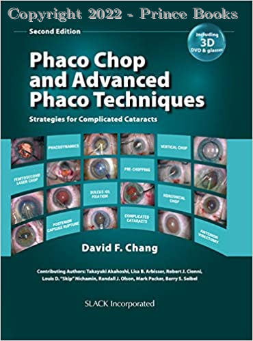 Phaco Chop and Advanced Phaco Techniques, 2e