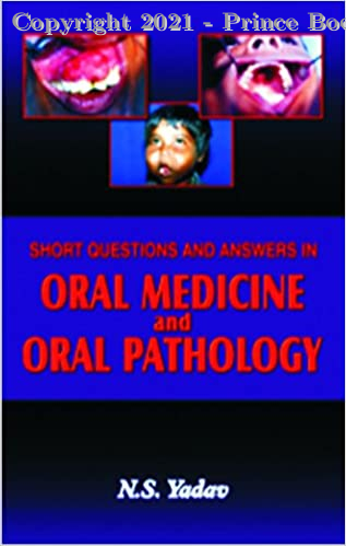 Short Questions and Answers in Oral Medicine and Oral Pathology