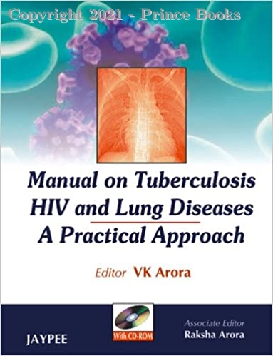 Manual on Tuberculosis HIV and Lung Diseases A Practical Approach, 1e