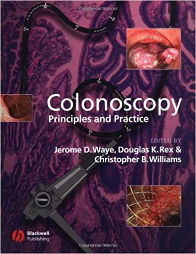 Colonoscopy: Principles and Practice