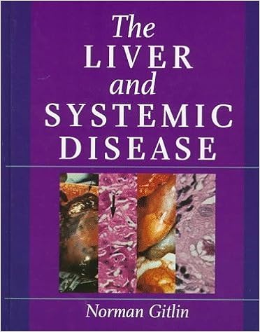 The Liver and Systemic Disease, 1e