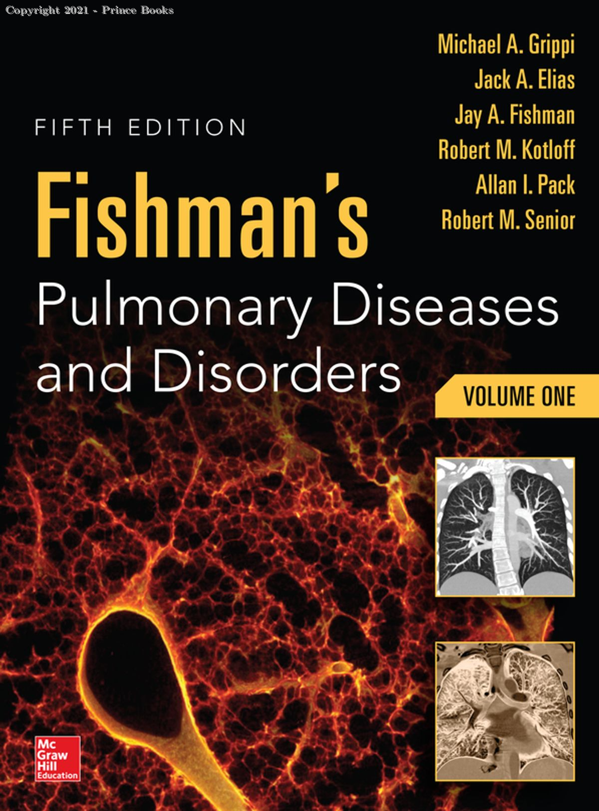 Fishman's Pulmonary Diseases and Disorders, 4vol set 