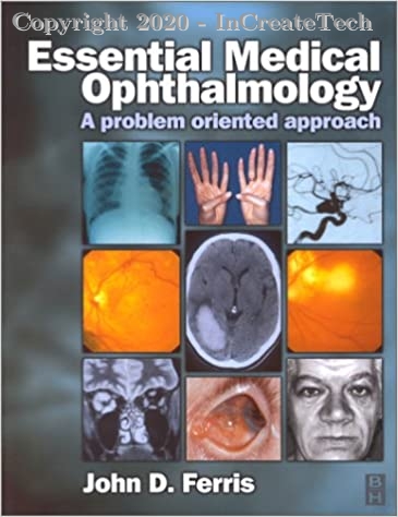 Essential Medical Ophthalmology: A Problem Oriented Approach, 1e