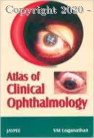 Atlas of Clinical Ophthalmology, 2e