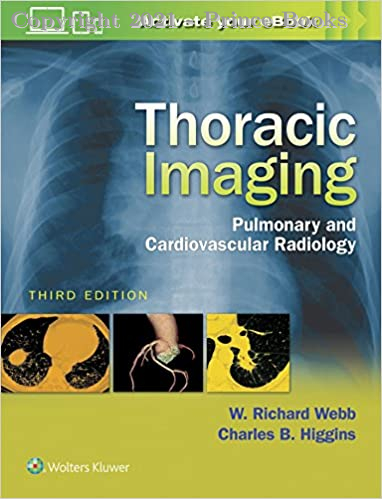thoracic imaging, 3e