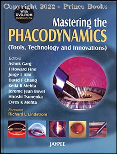 Mastering the Phacodynamics (Tools, Technology and Innovations),