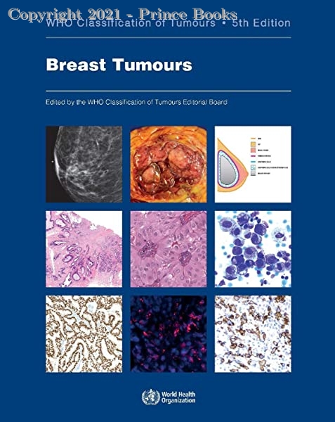 Breast Tumours WHO Classification of Tumours, 5e