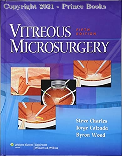 Vitreous Microsurgery, 5e