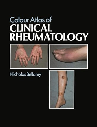 Colour Atlas of Clinical Rheumatology, 1e