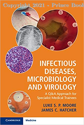 Infectious Diseases, Microbiology and Virology, 1E