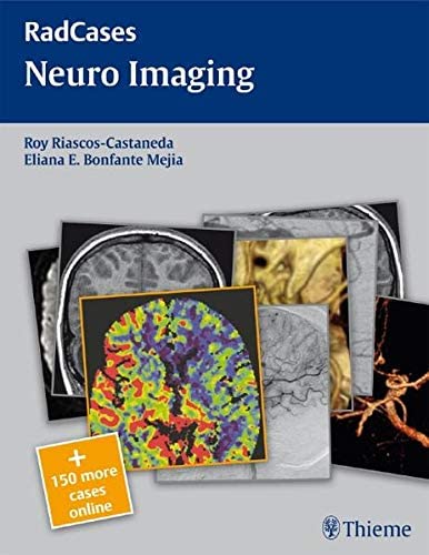Radcases Neuro Imaging 