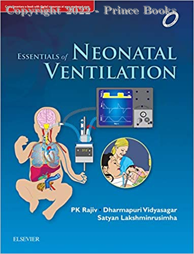 Essentials of Neonatal Ventilation, 1e