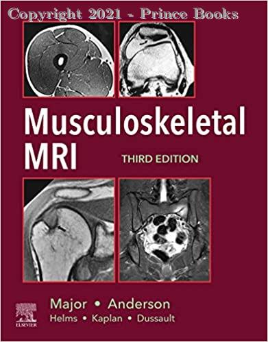 Musculoskeletal MRI, 3e