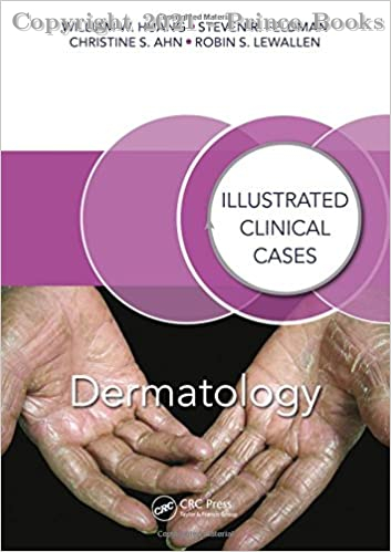 Dermatology Illustrated Clinical Cases