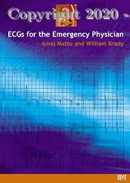 ECGs for the Emergency Physician