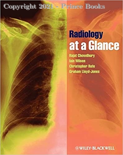 Radiology at a Glance, 1e