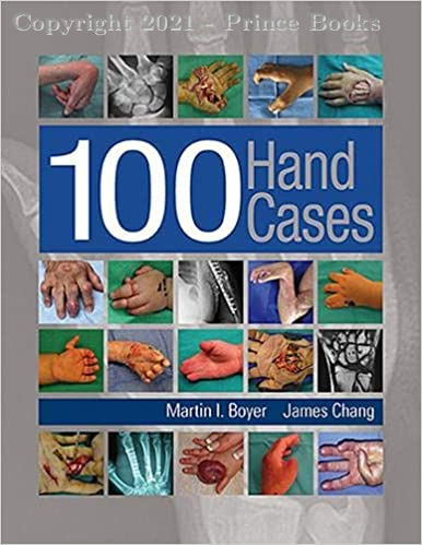 100 Hand Cases, 1e