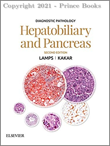 Diagnostic Pathology: Hepatobiliary and Pancreas, 2e