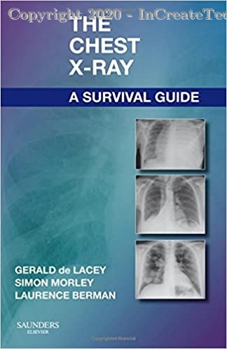 the chest x-ray a survival guide, 1e