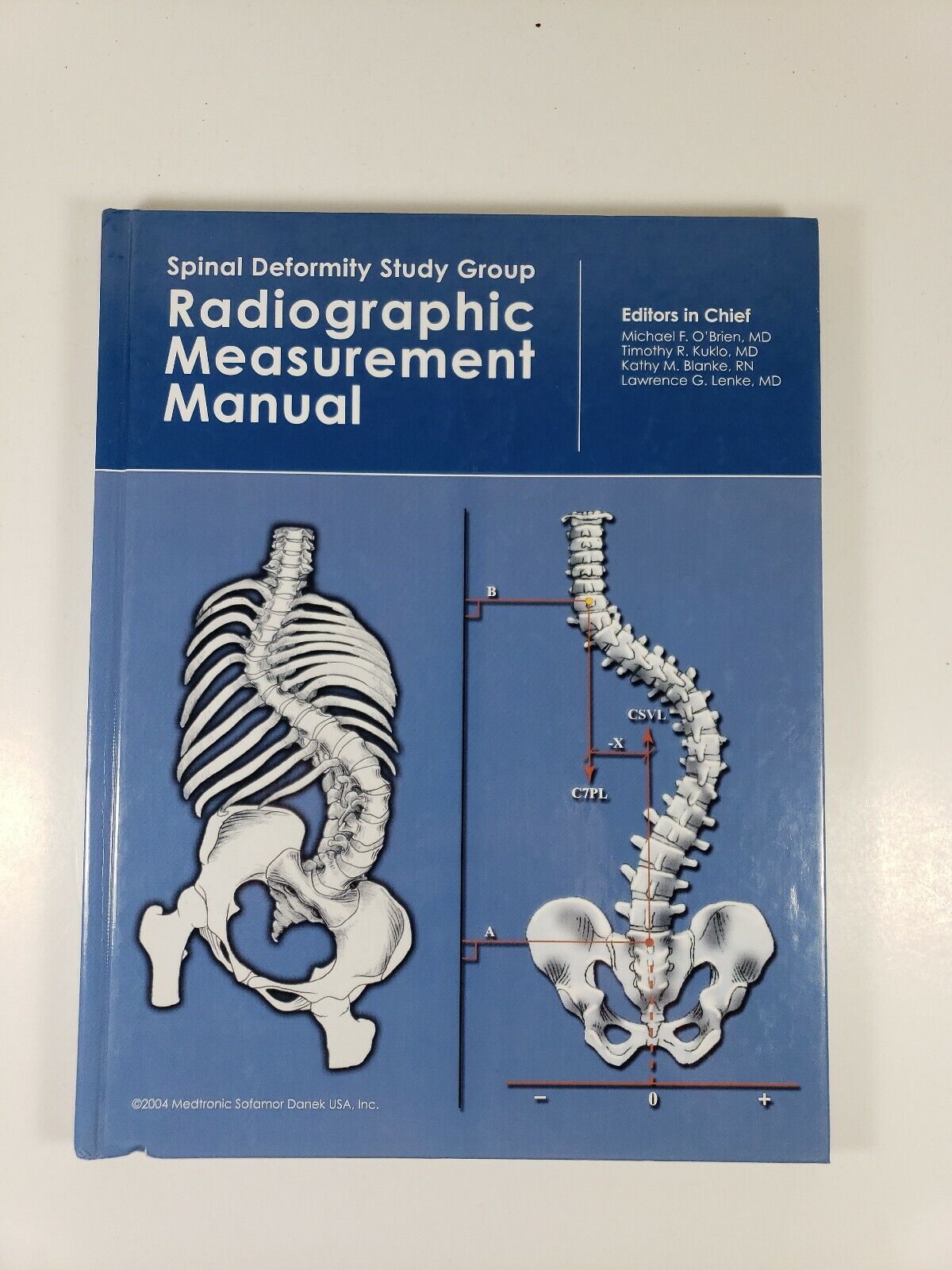 spinal deformity study group radiographic measurement manual