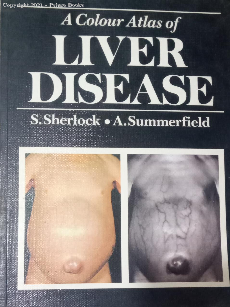 A Colour Atlas of Liver Disease