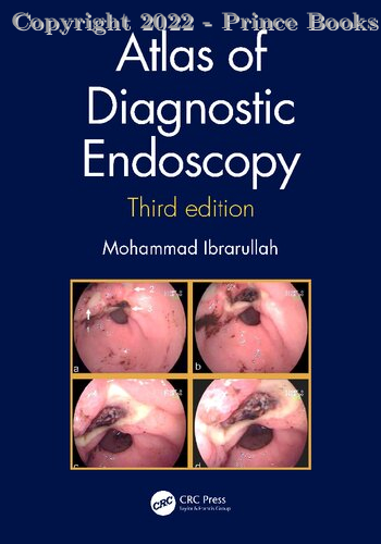 Atlas of diagnostic endoscopy, 3e