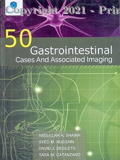 50 Gastrointestinal Cases and Associated Imaging, 1e