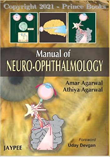 Manual of Neuro Ophthalmogy, 