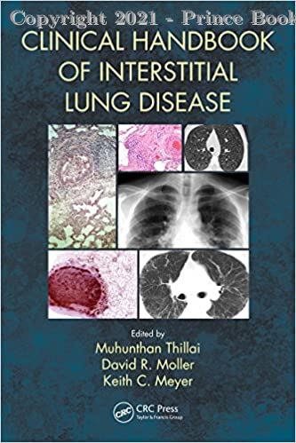 Clinical Handbook of Interstitial Lung Disease
