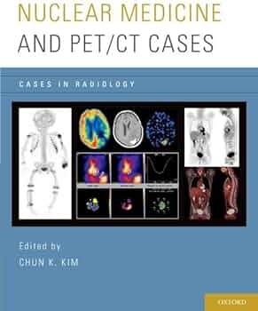 Nuclear Medicine and PET/CT Cases (Cases in Radiology) 1st Edi