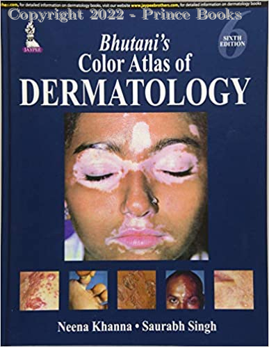 Bhutani's Color Atlas of Dermatology, 6E