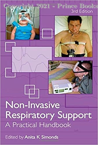 Non-Invasive Respiratory Support A Practical Handbook 
