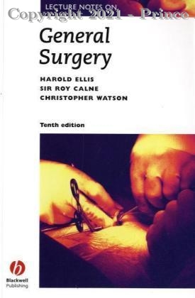 Lecture Notes on General Surgery, 10E